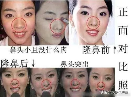 哪些女星本是天生丽质，却因整容整残了？