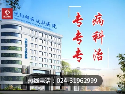沈阳牛皮癣专科医院【沈阳皮肤医院】