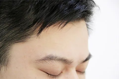 额头长痘怎么回事