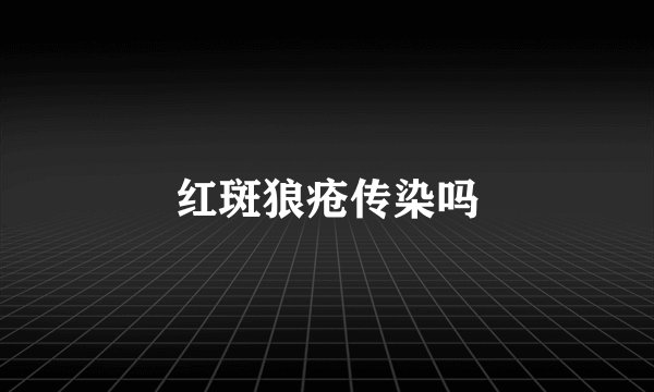 红斑狼疮传染吗