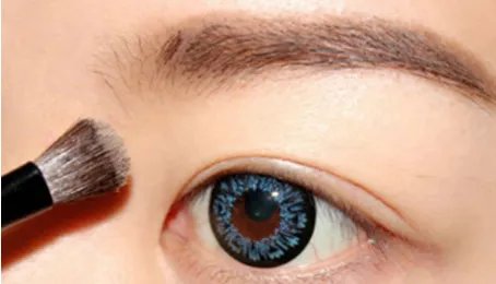 埋线双眼皮多久能恢复