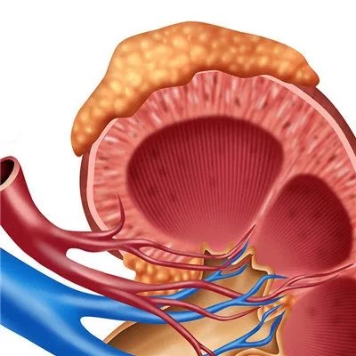 急性肾病综合症的症状