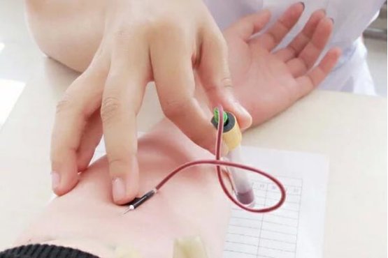 肝功能检查哪些项目