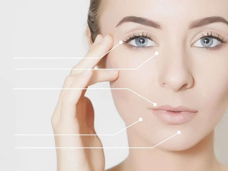 填充鼻唇沟的方法