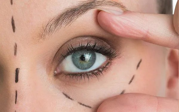 怎样快速去眼袋偏方