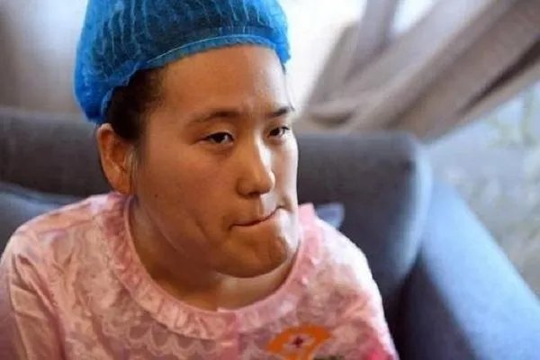 歪脸女孩整容成功后为何会想当老师？