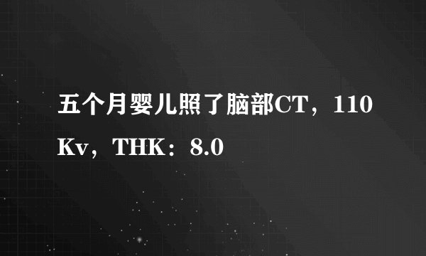 五个月婴儿照了脑部CT，110Kv，THK：8.0