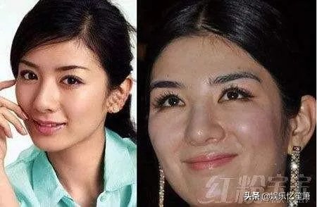哪些女星本是天生丽质，却因整容整残了？