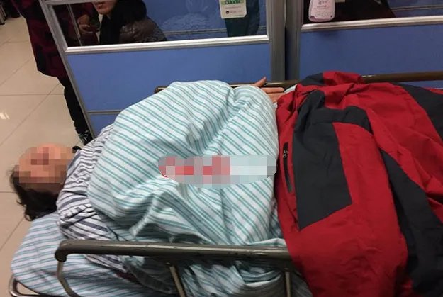 63岁大妈钱塘江游泳被渔船的螺旋桨打得皮开肉绽是怎么回事?