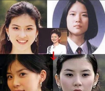 李宝英整容前后照片对比 李宝英个人资料及近照曝光