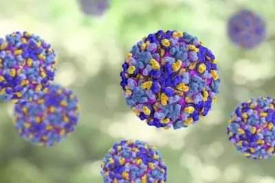 病毒性脑炎是怎么回事 讲述引发病毒性脑炎的4原因