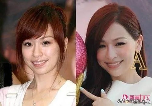 哪些女星本是天生丽质，却因整容整残了？