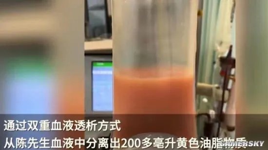 男子熬夜喝冰镇饮料被送进ICU 诱发急性胰腺炎