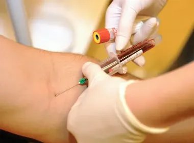 江苏发现两例全球罕见的黄金血型,这种血型的人群生病时能接受哪种血型呢?